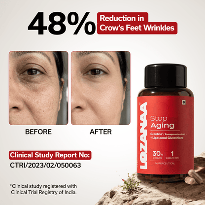 Lozanaa Stop Ageing Capsule - Lozanaa