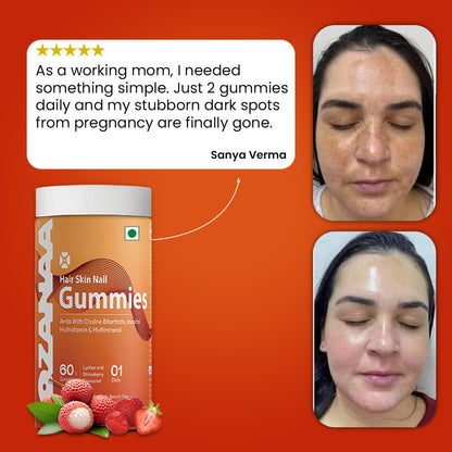 Stronger Hair, Glowing Skin & Healthier Nails in 60 Days - Lozanaa